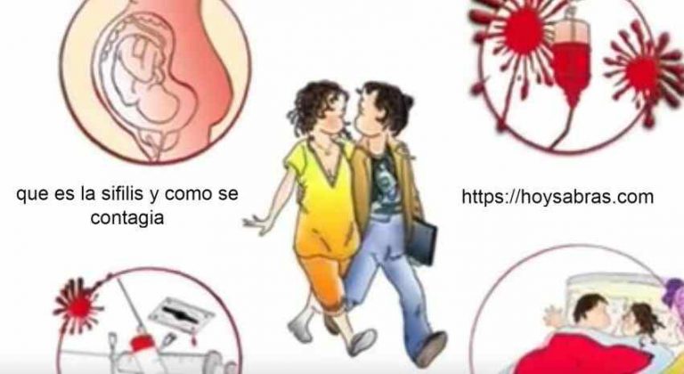 Como Se Contrae Una Infección Por Sífilis Y Cuál Es El Tratamiento??? 2025